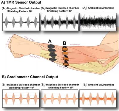 Motion artifact variability in biomagnetic wearable devices